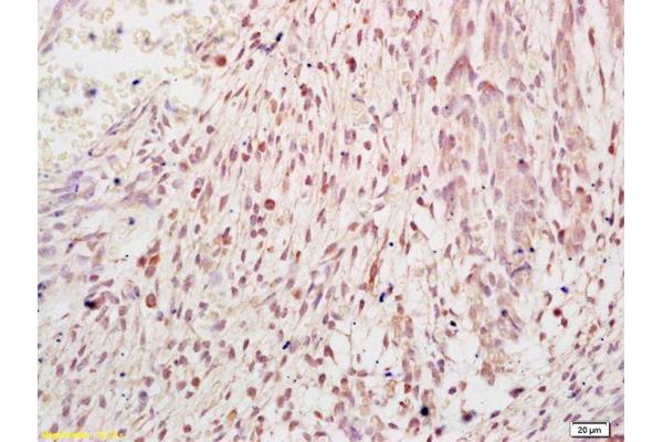 FBXO11 antibody  (AA 65-160)
