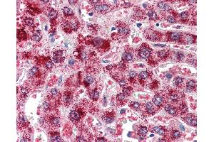 Anti-Catalase antibody IHC of human liver. (Catalase antibody  (AA 498-511))