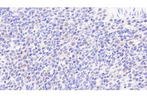 Detection of IL6 in Human Spleen Tissue using Polyclonal Antibody to Interleukin 6 (IL6) (IL-6 antibody  (AA 29-212))