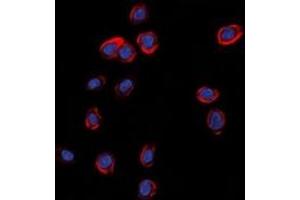 Immunofluorescent analysis of GLUR1 staining in A549 cells. (Glutamate Receptor 1 antibody  (C-Term))