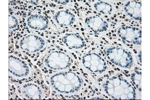 Image no. 1 for anti-Mitogen-Activated Protein Kinase Kinase 4 (MAP2K4) antibody (ABIN1499480) (MAP2K4 antibody)