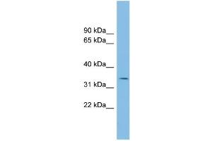 WB Suggested Anti-PCGF6 Antibody Titration: 0. (PCGF6 antibody  (Middle Region))