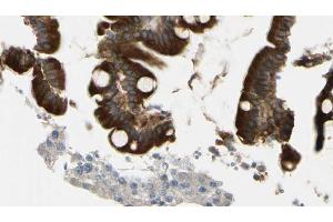 ABIN6269264 at 1/100 staining Mouse intestine tissue by IHC-P. (Crk antibody)