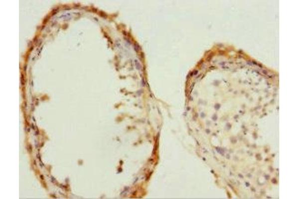 CDC7 antibody  (AA 275-574)