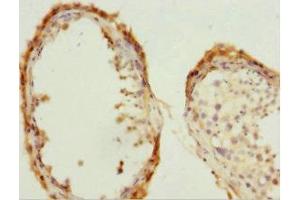 Immunohistochemistry of paraffin-embedded human testis tissue using ABIN7147293 at dilution of 1:100 (CDC7 antibody  (AA 275-574))