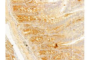 ABIN6255513 and ABIN6267630 at 1/100 staining Rat colon tissue by IHC-P. (Acetyl-CoA Carboxylase alpha antibody  (pSer79, pSer80))