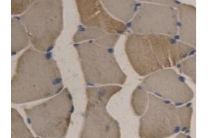 DAB staining on IHC-P; Samples: Rat Skeletal muscle Tissue (APOB antibody  (AA 2747-2913))