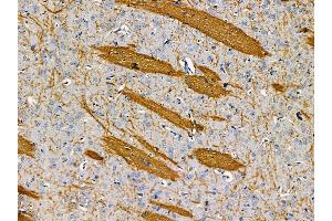 ABIN7095543 and ABIN7099600 at 1/100 staining rat brain tissue by IHC-P.