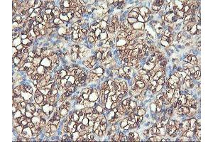 Image no. 1 for anti-phosphofructokinase, Platelet (PFKP) antibody (ABIN1500161) (PFKP antibody)