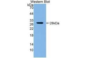Detection of recombinant ROR1 using Polyclonal Antibody to Receptor Tyrosine Kinase Like Orphan Receptor 1 (ROR1) (ROR1 antibody  (AA 470-707))