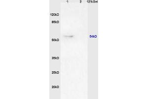Lane 1: rat brain lysates Lane 2: human colon carcinoma lysates probed with Anti GPS1/CSN1 Polyclonal Antibody, Unconjugated (ABIN1385980) at 1:200 in 4C.
