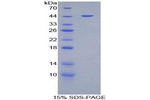 SDS-PAGE (SDS) image for Glial Fibrillary Acidic Protein (GFAP) (AA 253-354) protein (His tag,GST tag) (ABIN1879315) (GFAP Protein (AA 253-354) (His tag,GST tag))