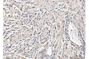 IHC analysis of RAE1 using anti-RAE1 antibody (ABIN7602428). (RAE1 antibody  (AA 76-368))