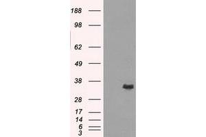 Image no. 3 for anti-Aldo-Keto Reductase Family 1, Member A1 (Aldehyde Reductase) (AKR1A1) antibody (ABIN1496542) (AKR1A1 antibody)