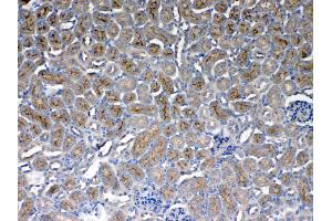 IHC analysis of CD151 using anti- CD151 antibody . (CD151 antibody  (AA 113-175))