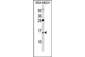 Western blot analysis of GUCA2B Antibody (C-term) in MDA-MB231 cell line lysates (35ug/lane).