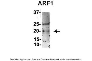 Sample Type : Mouse Brain lysate (ARF1 antibody  (Middle Region))