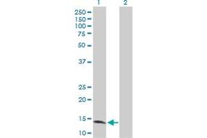 Western Blot analysis of ZNF44 expression in transfected 293T cell line by ZNF44 MaxPab polyclonal antibody. (Zinc Finger Protein 44 antibody  (AA 1-154))