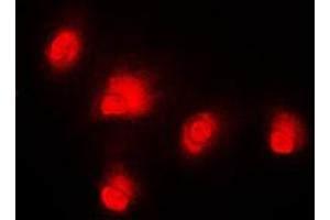 Immunofluorescent analysis of c-RAF staining in HeLa cells. (RAF1 antibody  (Center))