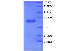 SDS-PAGE (SDS) image for Chromobox Homolog 7 (CBX7) (AA 1-251), (full length) protein (His tag) (ABIN4975696) (CBX7 Protein (AA 1-251, full length) (His tag))