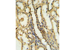 TRAP Antibody IHC analysis in formalin fixed and paraffin embedded human kidney tissue followed by peroxidase conjugation of the secondary antibody and DAB staining.