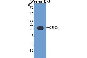 Western Blotting (WB) image for anti-Coagulation Factor V (F5) (AA 1941-2095) antibody (ABIN1173407) (Coagulation Factor V antibody  (AA 1941-2095))