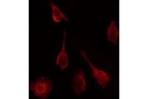 Immunofluorescence (fixed cells) (IF/ICC) image for anti-Ribosomal Protein S9 (RPS9) (Internal Region) antibody (ABIN6264860)