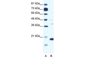WB Suggested Anti-CACNG1 Antibody Titration:  0. (CACNG1 antibody  (N-Term))