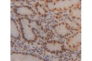 Used in DAB staining on fromalin fixed paraffin- embedded stomach tissue (HMG20B antibody  (AA 27-213))