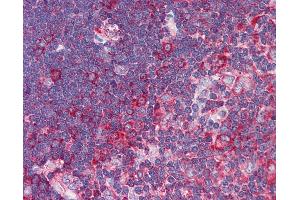 Anti-TNFRSF10A / DR4 antibody IHC of human thymus. (TNFRSF10A antibody)