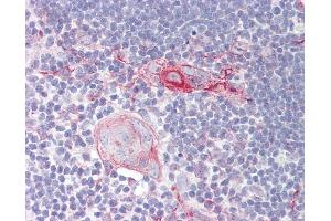 IL28RA antibody  (AA 51-100)