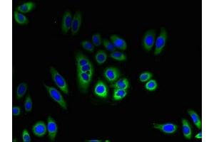 Immunofluorescent analysis of HepG2 cells using ABIN7173111 at dilution of 1:100 and Alexa Fluor 488-congugated AffiniPure Goat Anti-Rabbit IgG(H+L) (TMEM184C antibody  (AA 107-178))
