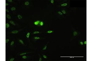 Immunofluorescence of purified MaxPab antibody to SFRS14 on HeLa cell. (SFRS14 antibody  (AA 1-988))