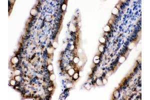 Immunohistochemistry (Paraffin-embedded Sections) (IHC (p)) image for anti-Keratin 19 (KRT19) (AA 334-372), (C-Term) antibody (ABIN3043288) (Cytokeratin 19 antibody  (C-Term))