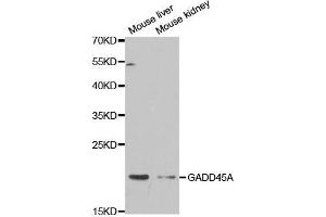 Western blot analysis of extracts of various cell lines, using GADD45A antibody. (GADD45A antibody  (AA 1-165))