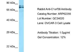 Western Blotting (WB) image for anti-Chromosome 1 Open Reading Frame 38 (C1orf38) (C-Term) antibody (ABIN2789083) (C1orf38 antibody  (C-Term))