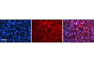 Rabbit Anti-MBD2 Antibody    Formalin Fixed Paraffin Embedded Tissue: Human Adult liver  Observed Staining: Nuclear Primary Antibody Concentration: 1:100 Secondary Antibody: Donkey anti-Rabbit-Cy2/3 Secondary Antibody Concentration: 1:200 Magnification: 20X Exposure Time: 0. (MBD2 antibody  (N-Term))