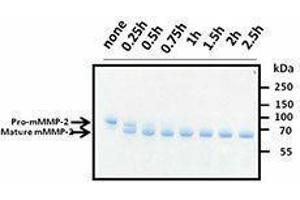 SDS-PAGE (SDS) image for Matrix Metalloproteinase 2 (MMP2) (AA 34-662), (C-Term) (Active) protein (ABIN2666505) (MMP2 Protein (AA 34-662, C-Term))