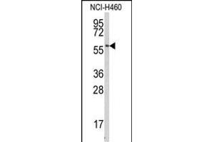 Western blot analysis of anti-BACE1C Antibody (Center) (ABIN6242327 and ABIN6578969) in NCI- cell line lysates (35 μg/lane). (BACE1C (AA 125-154) antibody)