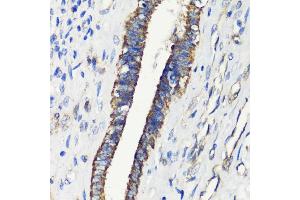 Immunohistochemistry (IHC) image for anti-FK506 Binding Protein 1A, 12kDa (FKBP1A) (AA 1-108) antibody (ABIN3022504)