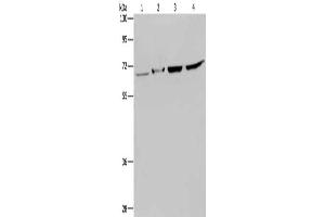 Gel: 8 % SDS-PAGE, Lysate: 40 μg, Lane 1-4: Human testis tissue, mouse liver tissue, Hela cells, 293T cells, Primary antibody: ABIN7129681(HACL1 Antibody) at dilution 1/200, Secondary antibody: Goat anti rabbit IgG at 1/8000 dilution, Exposure time: 5 minutes (HACL1 antibody)
