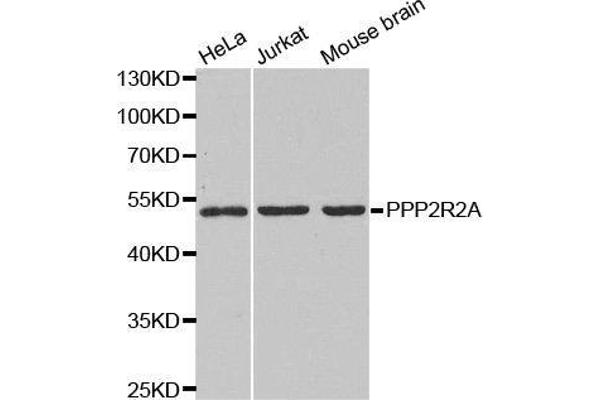 PPP2R2A antibody  (AA 1-447)