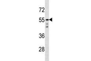 AKT1 antibody western blot analysis in T47D lysate (AKT1 antibody  (AA 438-468))