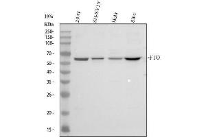 Western blot analysis of FTO using anti-FTO antibody (ABIN7601059).