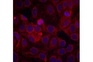Immunofluorescence staining of methanol-fixed MCF7 cells using VEGFR2 (phospho-Tyr1175) antibody (E011084, Red) (VEGFR2/CD309 antibody  (pTyr1175))