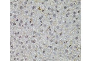 Immunohistochemistry of paraffin-embedded Mouse liver using SKP2 Polyclonal Antibody at dilution of 1:100 (40x lens).
