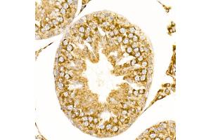 Immunohistochemistry of paraffin-embedded rat testis using G1 Rabbit mAb (ABIN7265718) at dilution of 1:50 (40x lens).