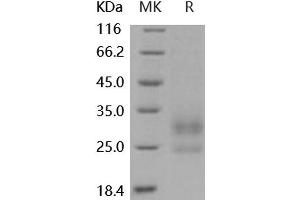 Western Blotting (WB) image for Lymphocyte Antigen 86 (LY86) protein (His tag) (ABIN7320457) (LY86 Protein (His tag))