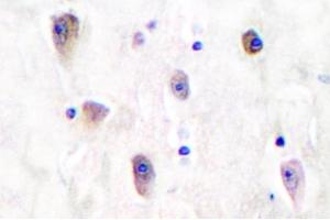 Image no. 2 for anti-Glutamate Receptor, Ionotropic, Kainate 1 (GRIK1) antibody (ABIN265438)