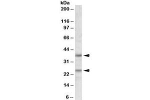 Western blot testing of human cerebellum lysate with Podoplanin antibody at 1ug/ml. (Podoplanin antibody)
